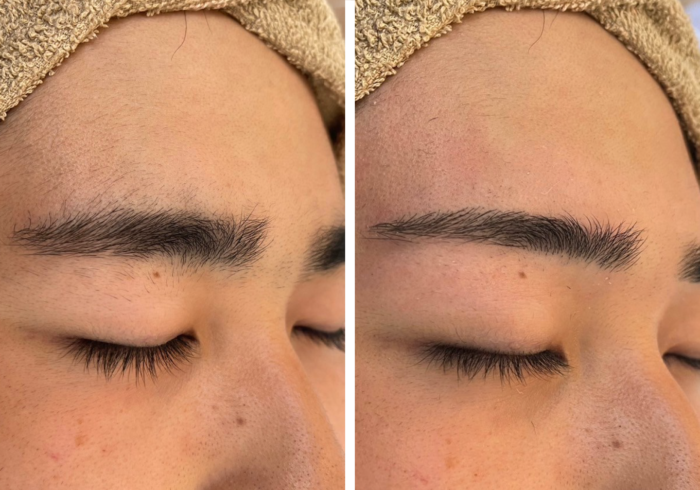 眉毛デザインのビフォアー・アフター写真No.2