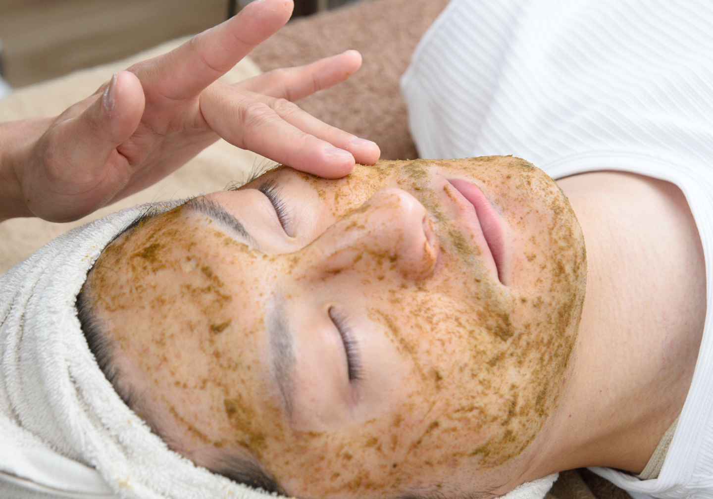 ハーブピーリング・ニキビケアの施術写真