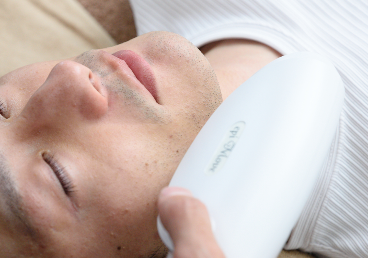 メンズ光フォトフェイシャルの施術写真